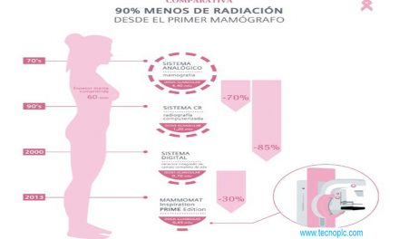 Radiación de una mamografía: porcentajes y medidas.