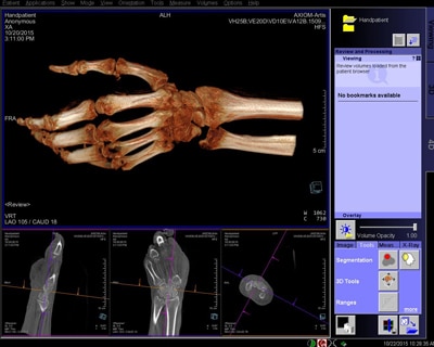 Imagen 3D tomada con Sistema rayos X robotizado.